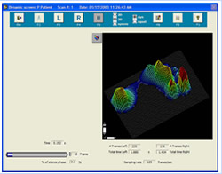Gait Scan