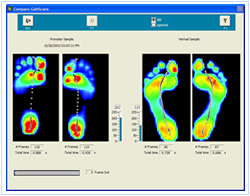 Gait Scan