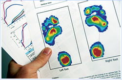 Gait Scan Report