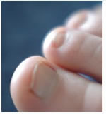 Nail Care