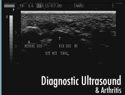 Diagnostic Ultrasound